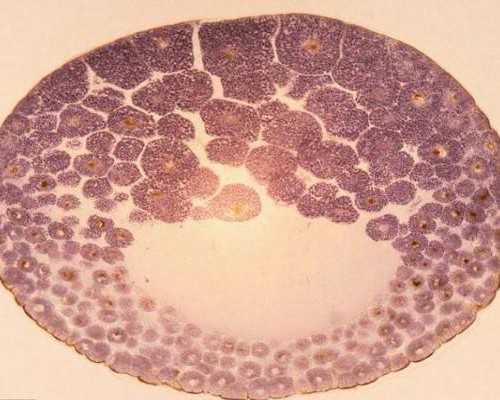 武汉借卵医院秦皇岛,武汉人类精子库可以存精子吗